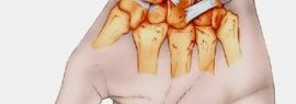 Os et ligaments du poignet 