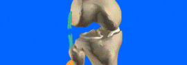 Rupture du ligament latéral externe