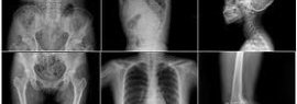 Radiographie